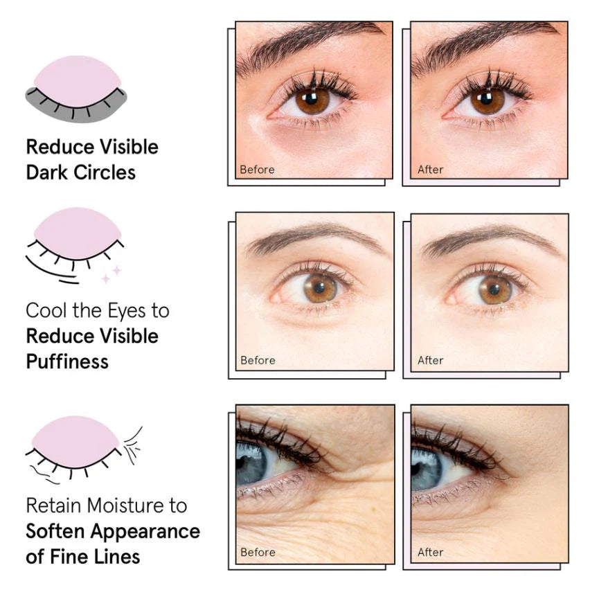 under eye masks for puffy eyes