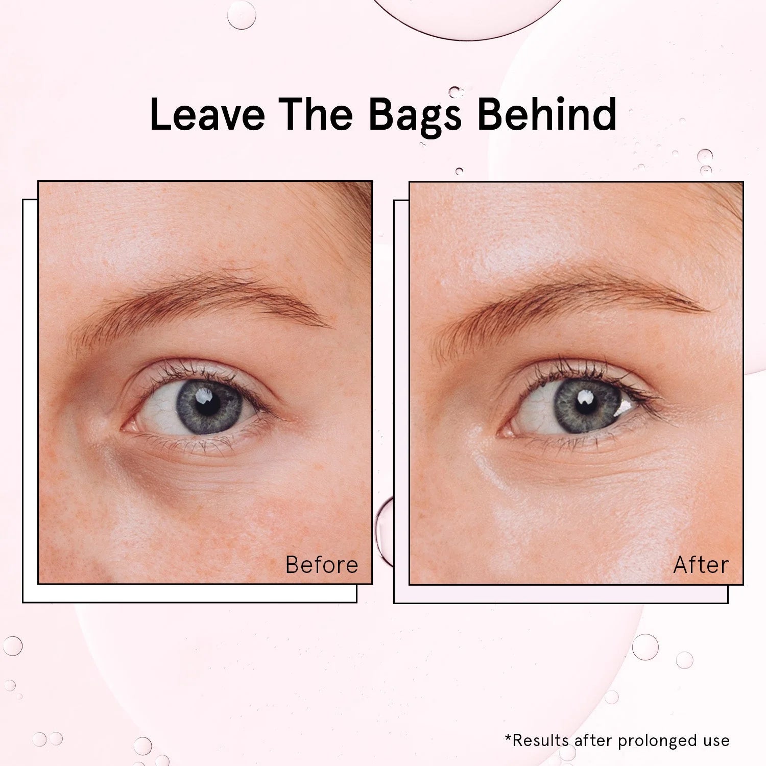 de-puffing eye serum roller